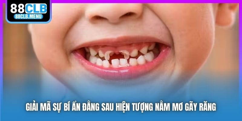 Nằm Mơ Gãy Răng Mang Điềm Báo Gì? Nên Đánh Đề Con Nào? - GARICO.INFO